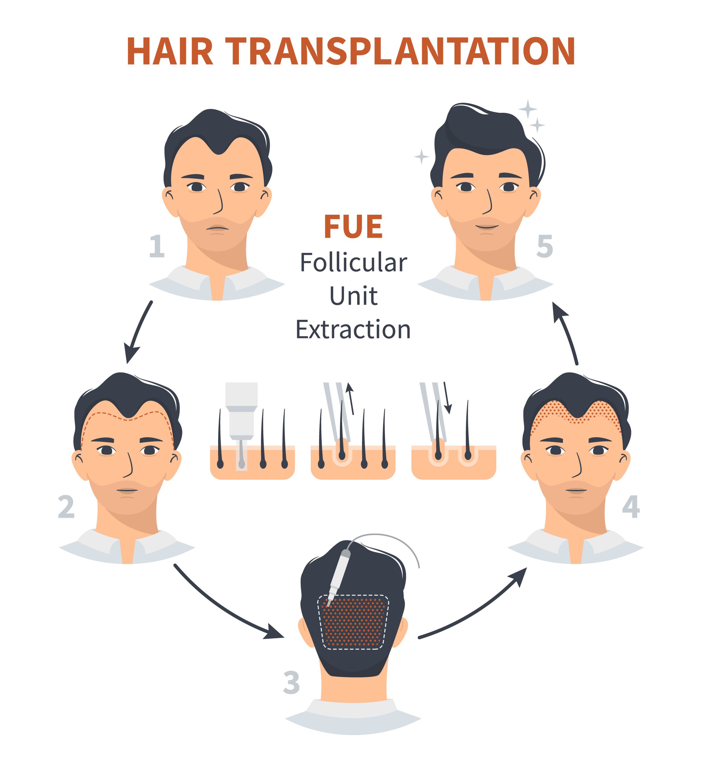 thai hair transfer