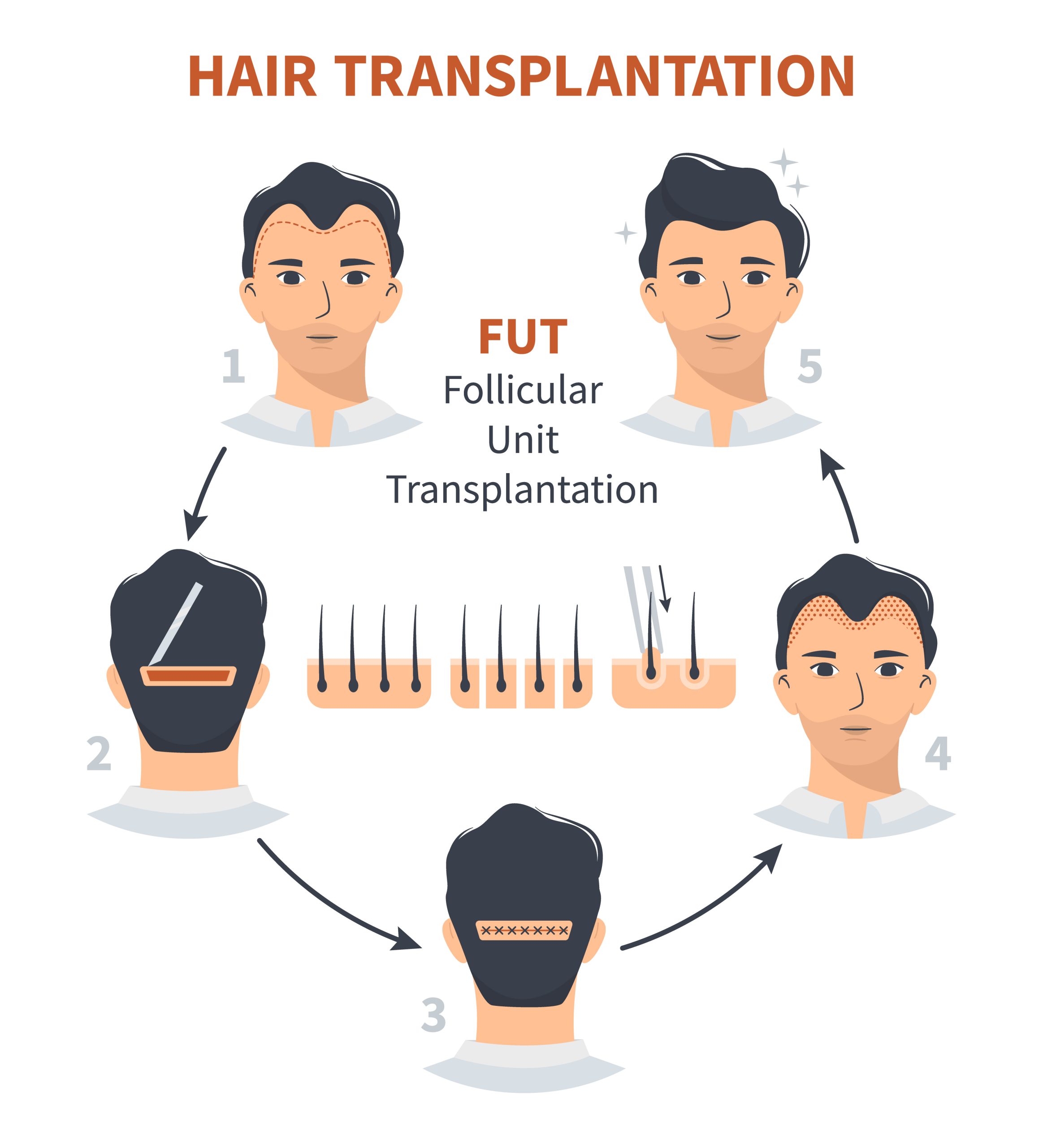 thai hair transfer
