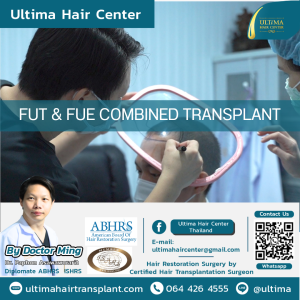 FUT FUE COMBINED HAIR TRANSPLANT