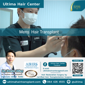 Mens Hair Transplant