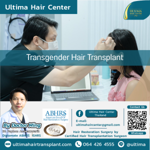 Transgender Hair Transplant