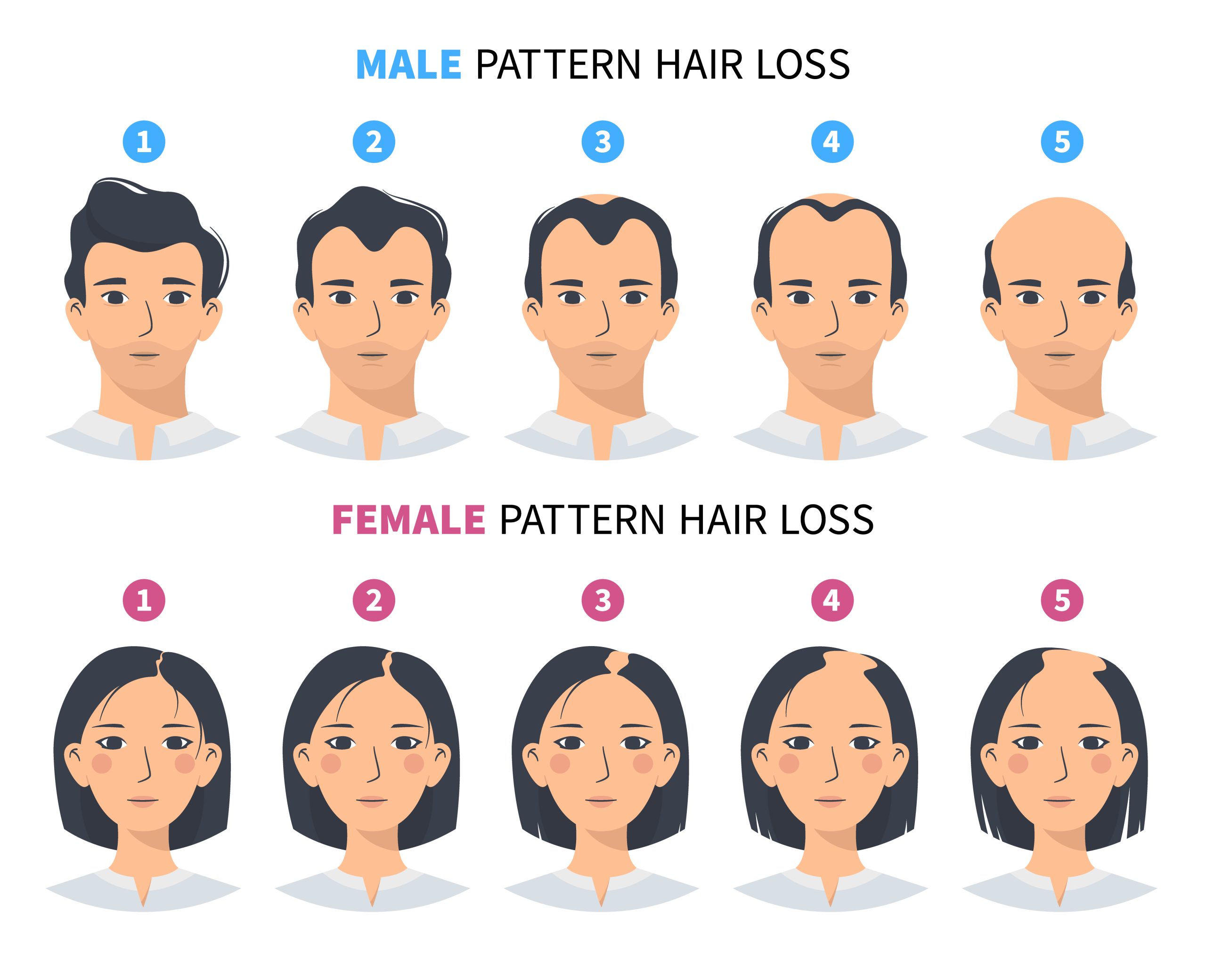 causes of hairloss