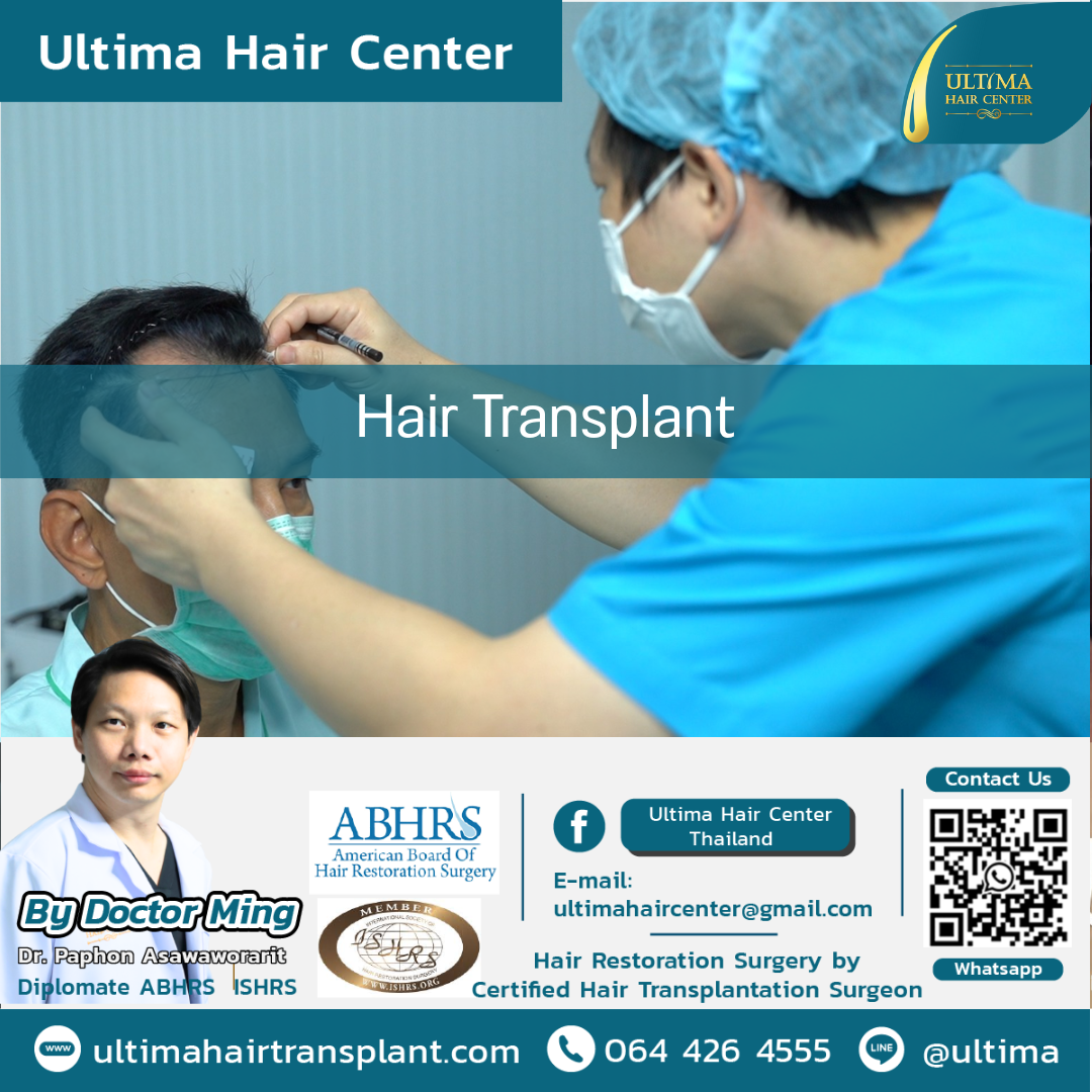 hair transplant