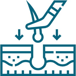 ultima hair transplant