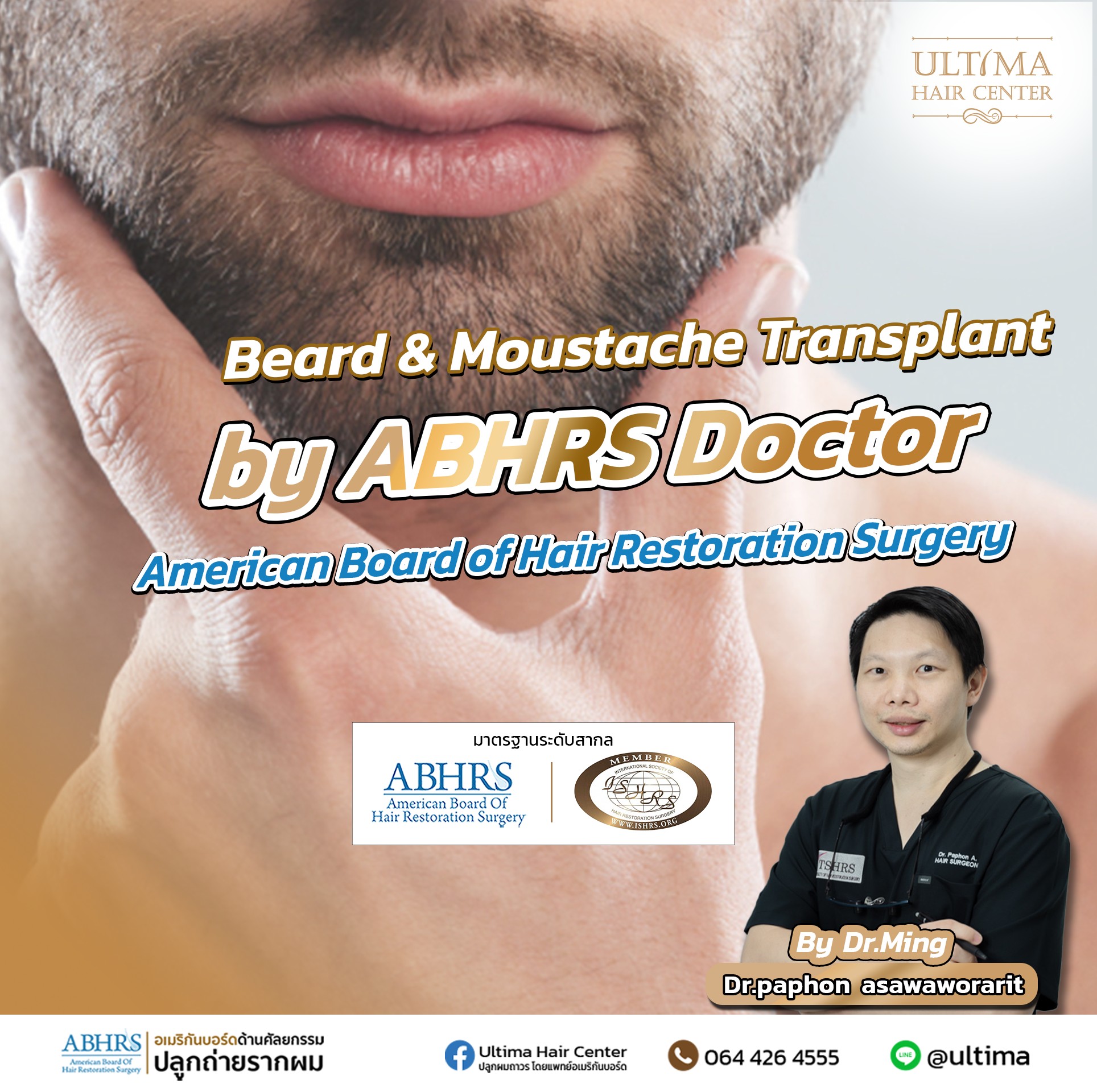Beard transplant