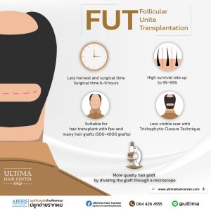thai hair transplant