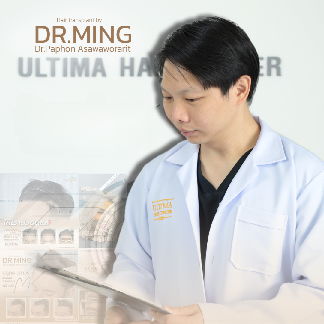 ultima hair transplant