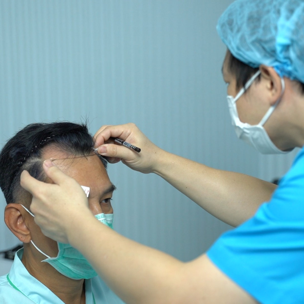 thai hair transplant