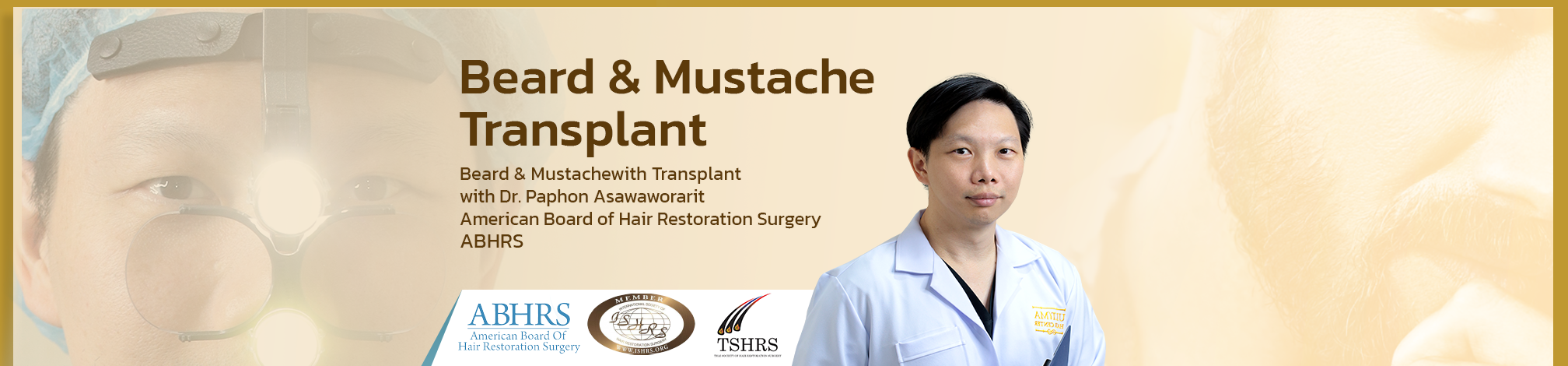 beard transplant