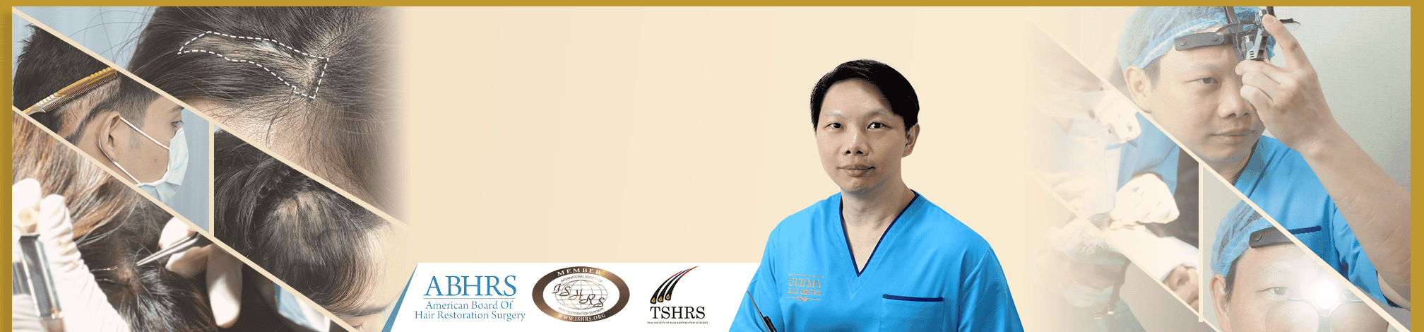 ultima hair transplant