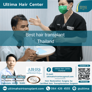 Best hair transplant Thailand