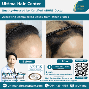 Why is hair transplant in Thailand often more affordable