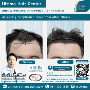 Medical tourism Thailand for hair transplant