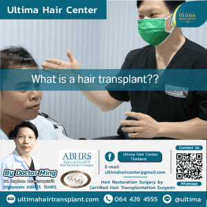 What is a hair transplant