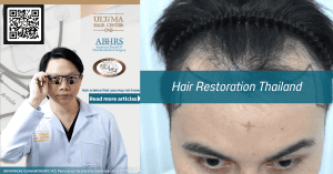 Hair Restoration Thailand
