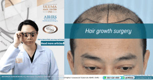 Hair growth surgery