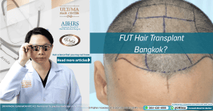 FUT Hair Transplant Bangkok