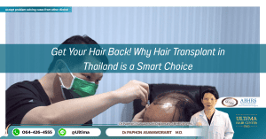 Get Your Hair Back! Why Hair Transplant in Thailand is a Smart Choice