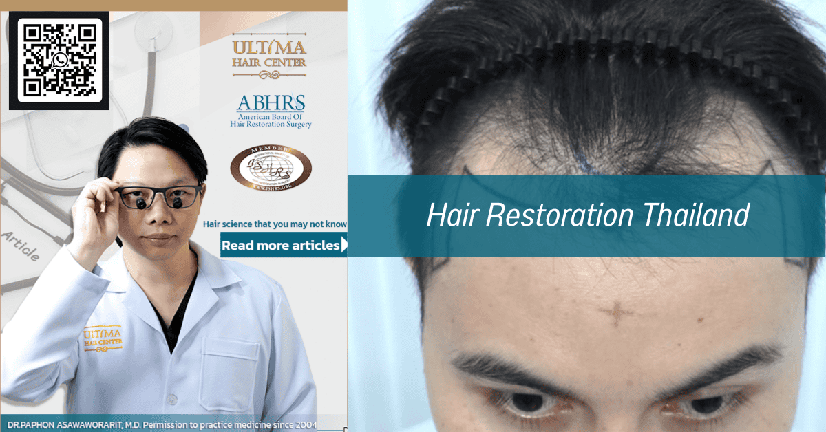 FUT hair transplant Thailand