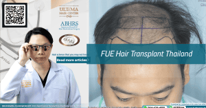 FUE Hair Transplant Thailand
