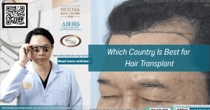 Which Country Is Best for Hair Transplant