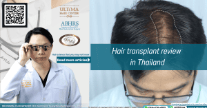 Hair transplant review in Thailand