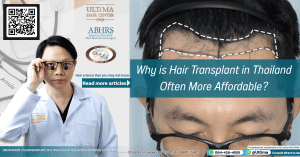 Why is hair transplant in Thailand often more affordable