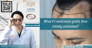 What if I need more grafts than initially estimated