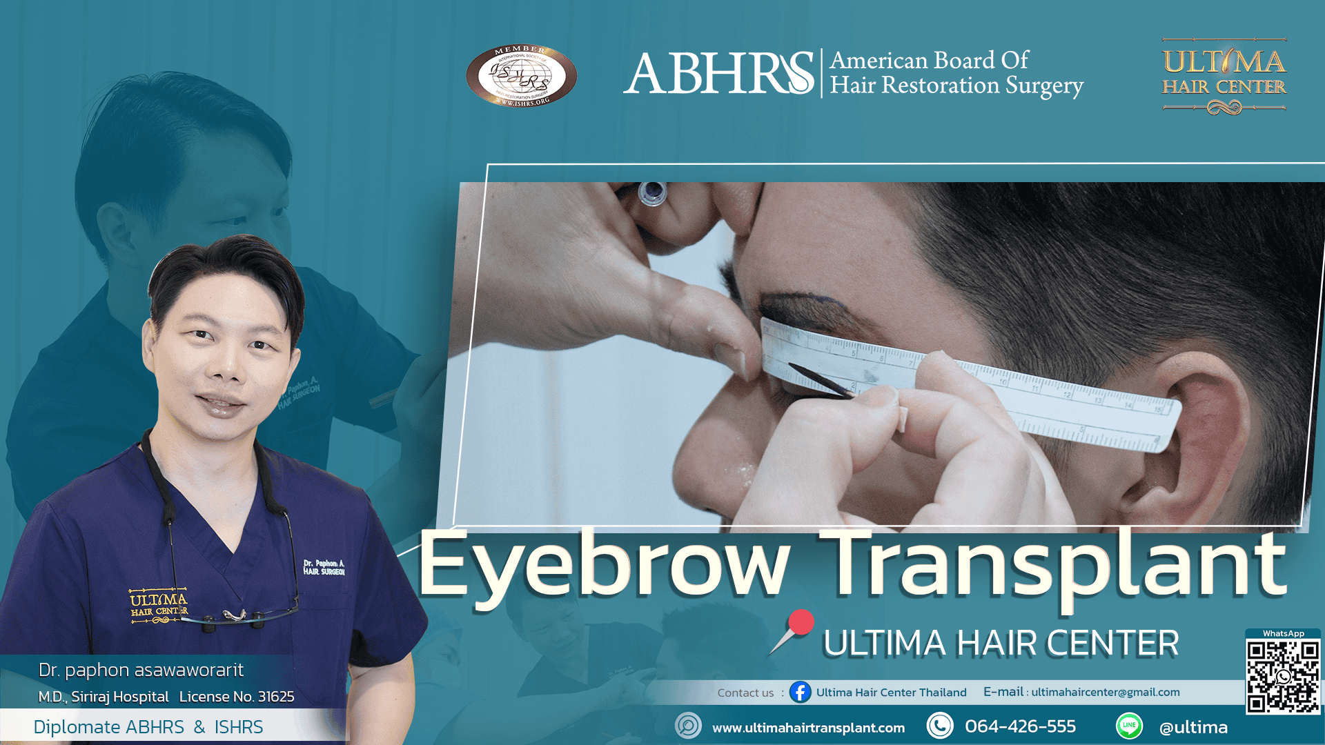 Who is Suitable for Eyebrow Transplantation