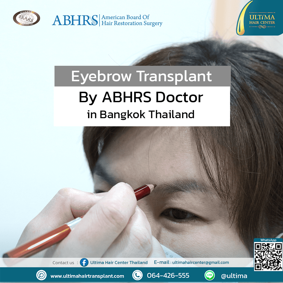 What is an Eyebrow Transplant