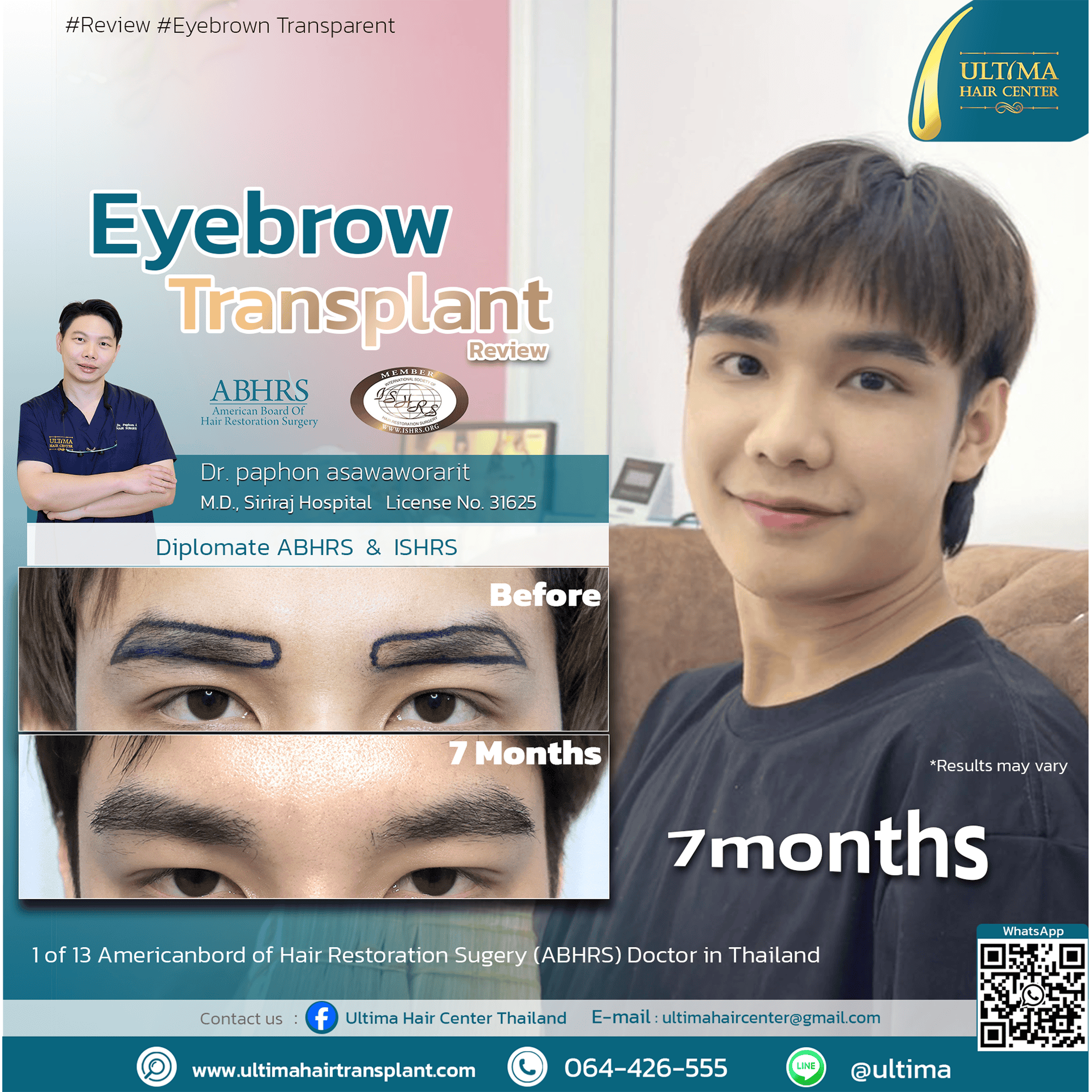 What is an Eyebrow Transplant