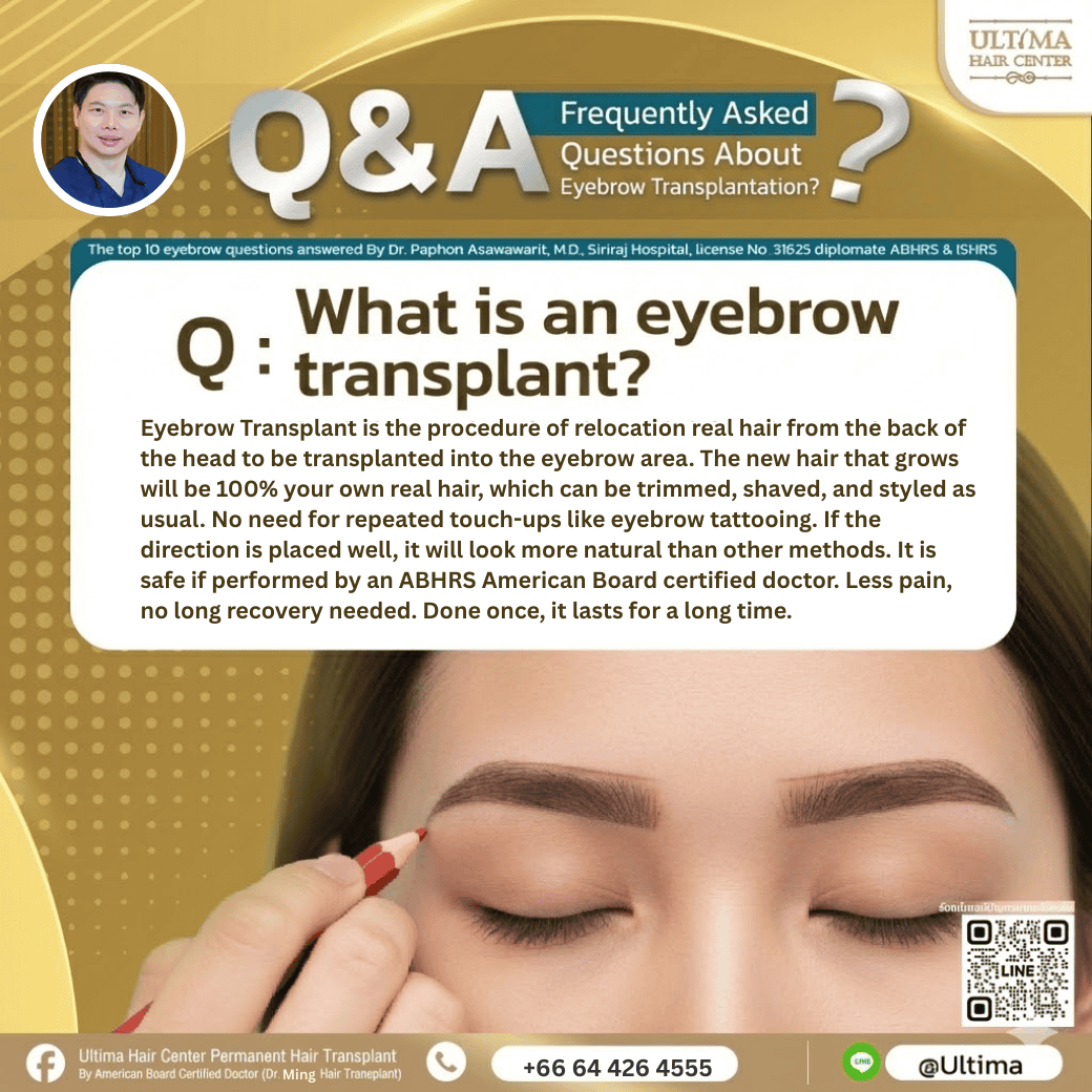 eyebrow hair transplant