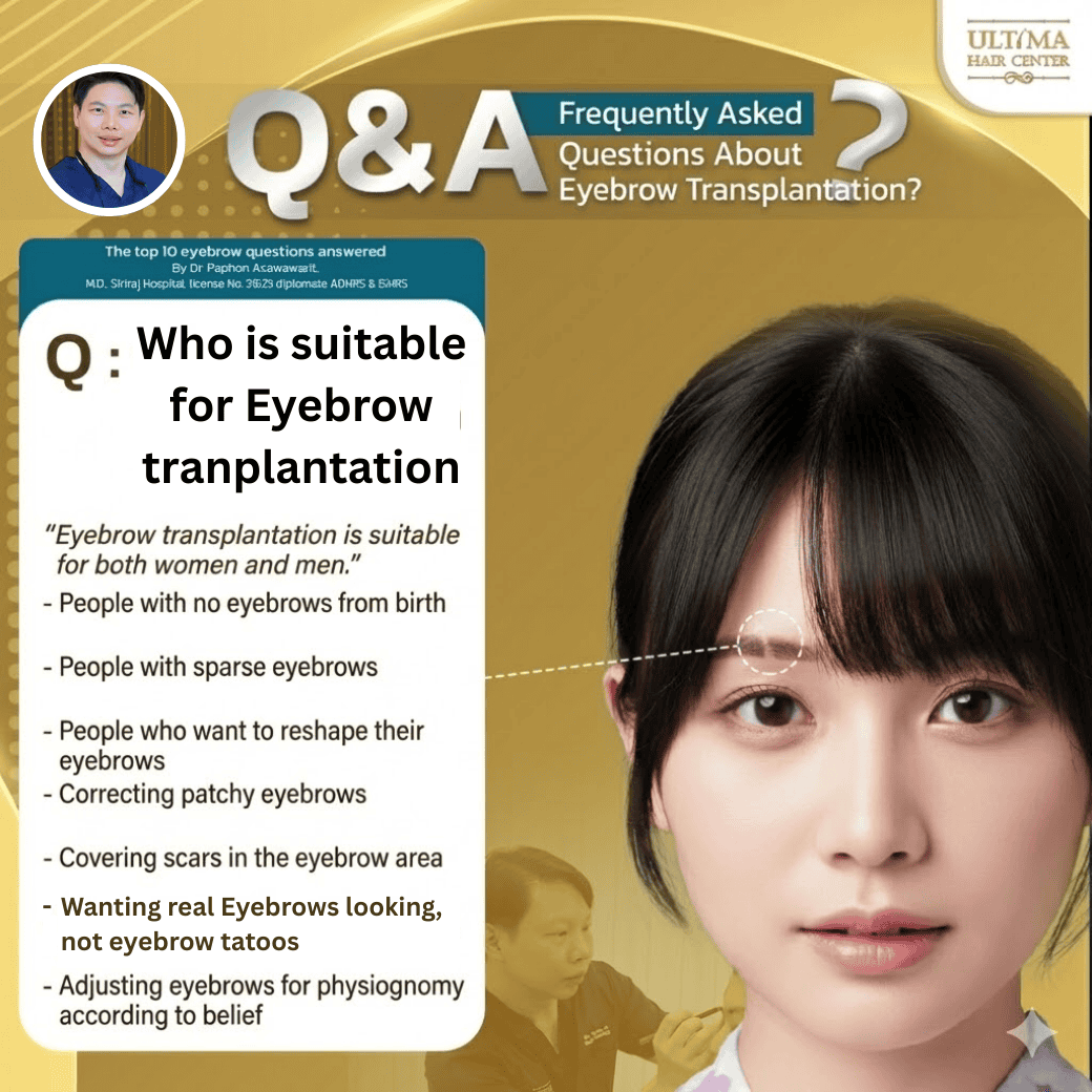 Who is Suitable for Eyebrow Transplantation