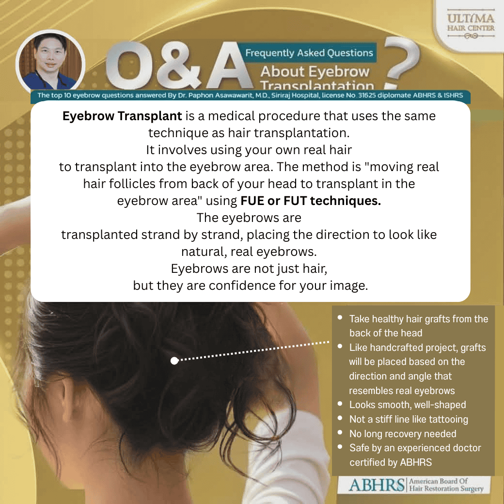 eyebrow hair transplant