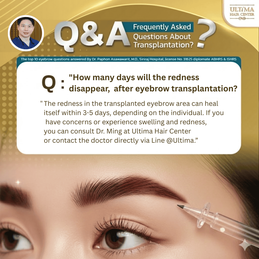 eyebrow hair transplant