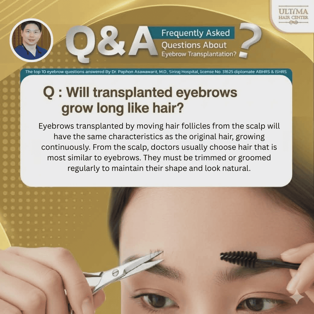 eyebrow hair transplant