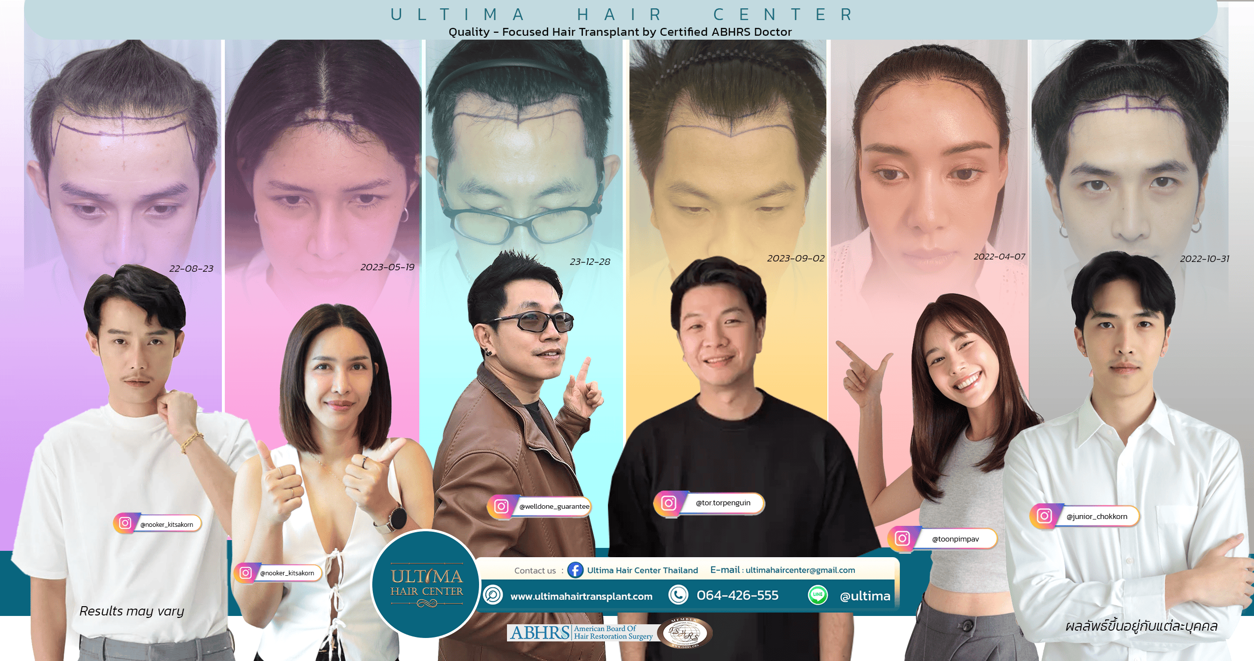 hair transplant thailand