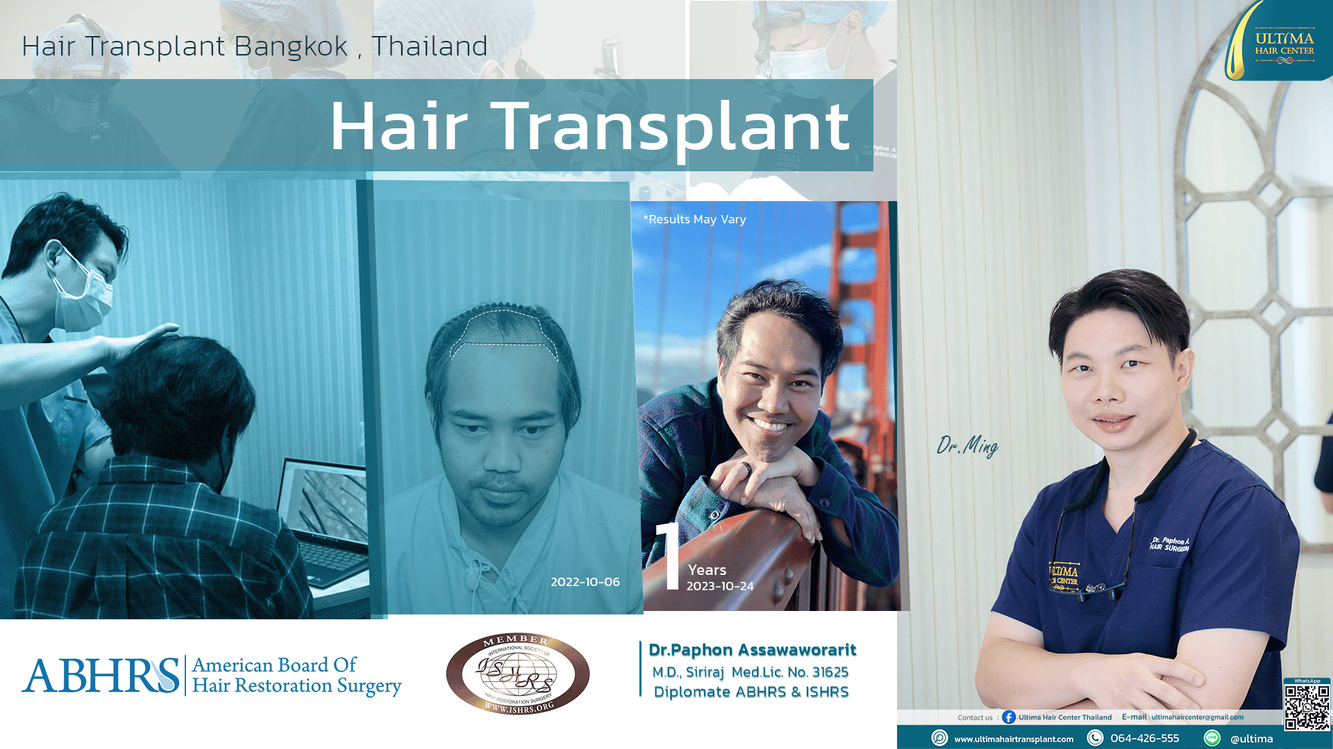 hair transplant thailand