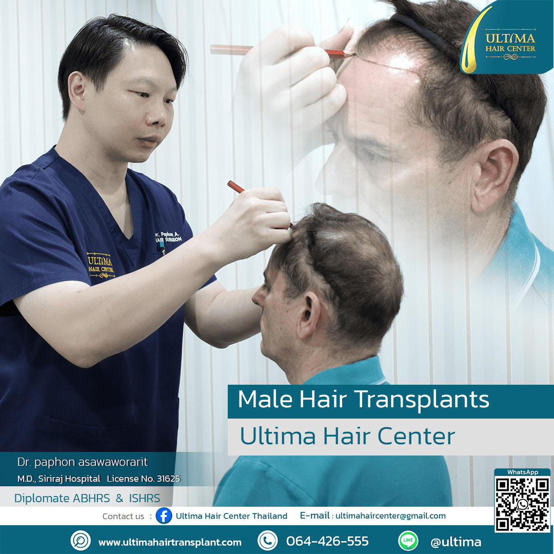 man hair transplant