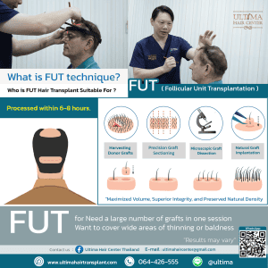 man hair transplant bangkok