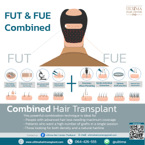 man hair transplant bangkok