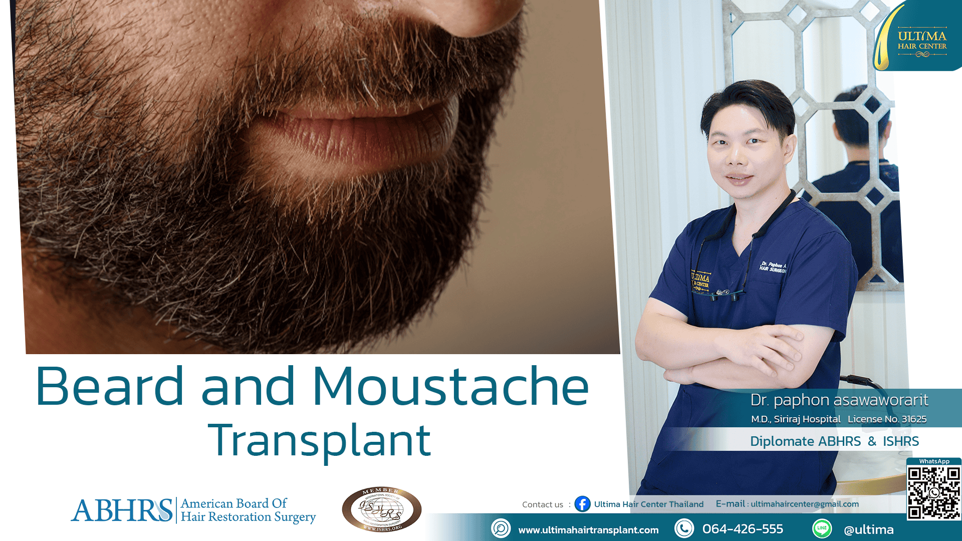 mustache transplant