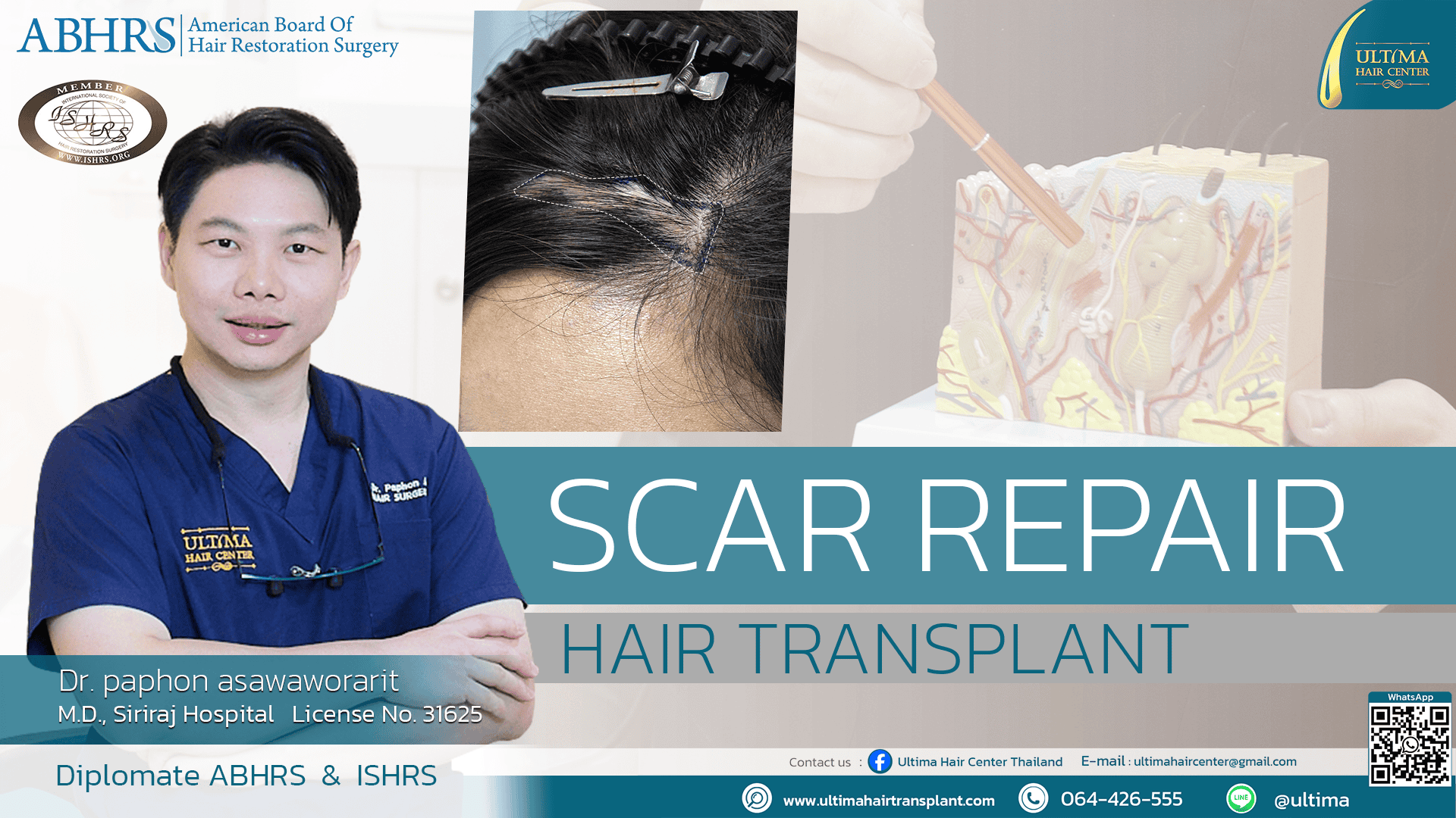 scar repair1
