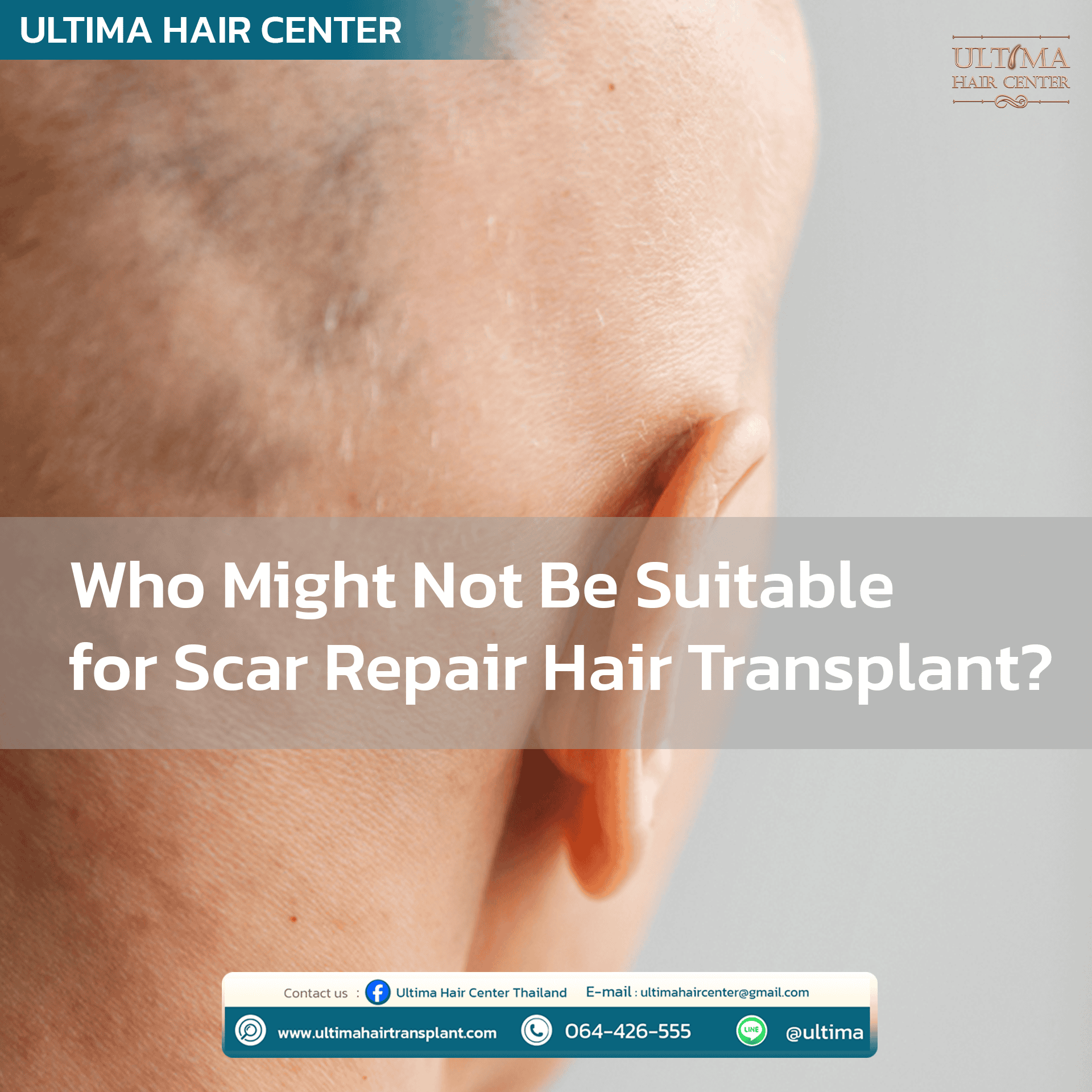 scar repair hair transplant