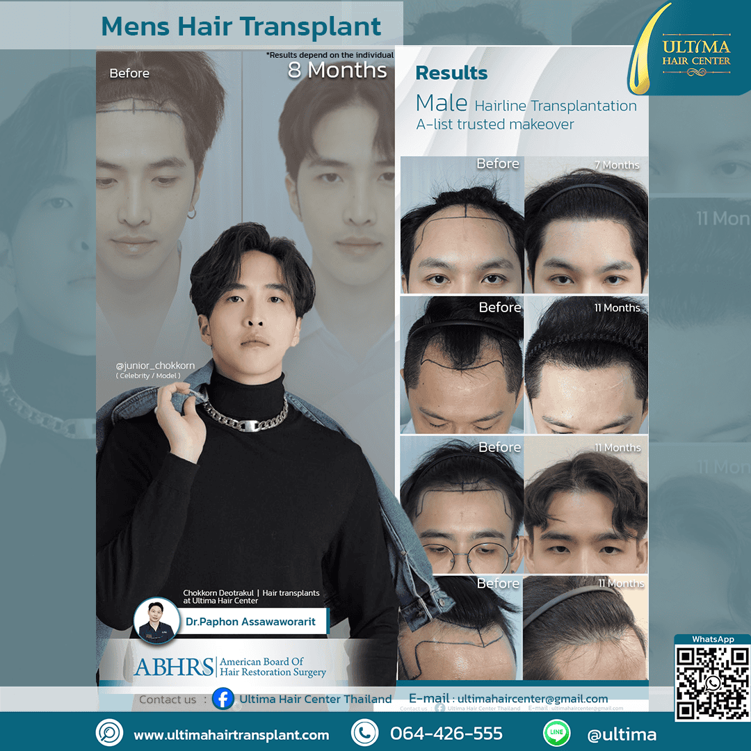 hair transplant clinic thailand