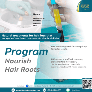 Hair Transplant Bangkok