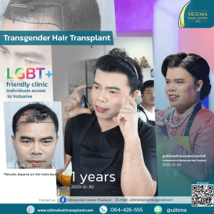 Hair Transplant Bangkok