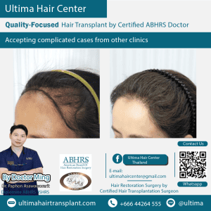 woman hair transplant