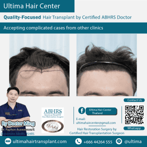 man hair transplant