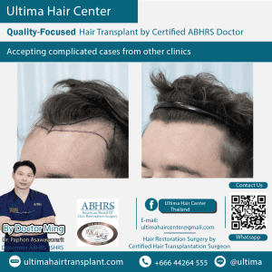 man hair transplant